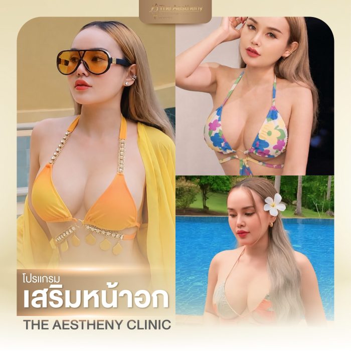 02to06-The Aestheny-M1-01