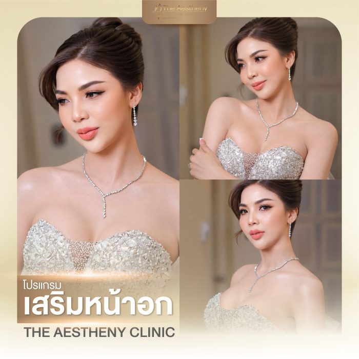 02to06-The Aestheny-M1-04