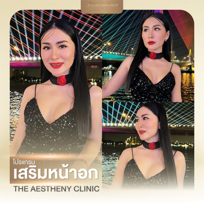 02to06-The Aestheny-M1-05