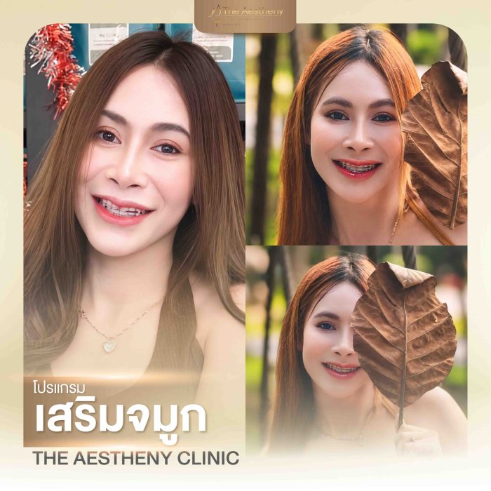 11to12-The Aestheny-M1-01