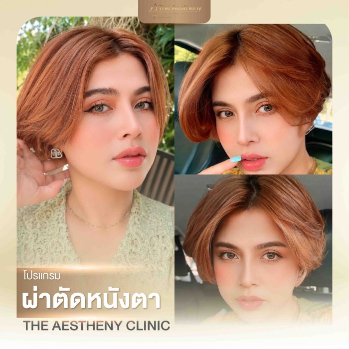 14-The Aestheny-M1-01