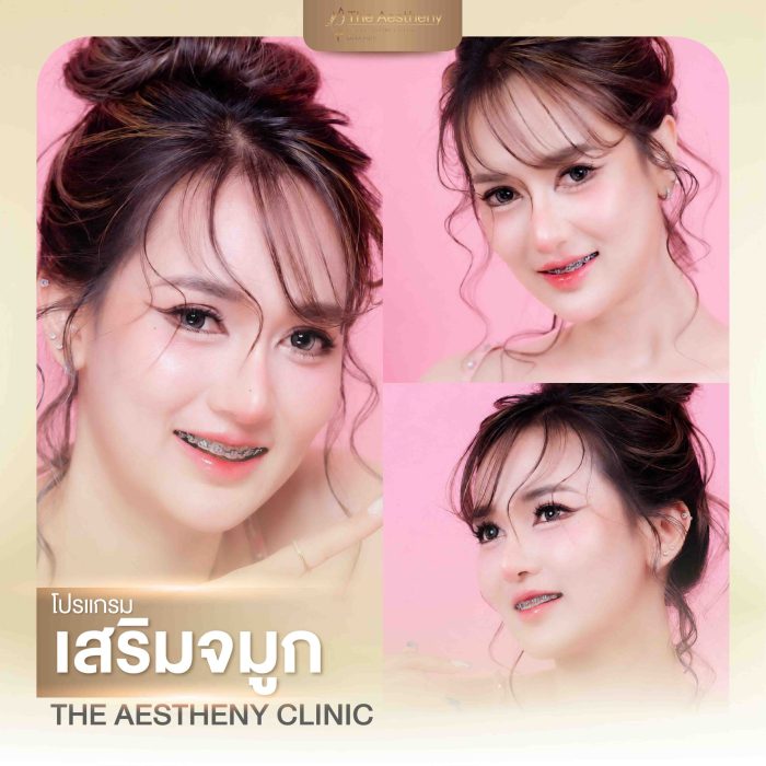 15-The Aestheny-M1-01