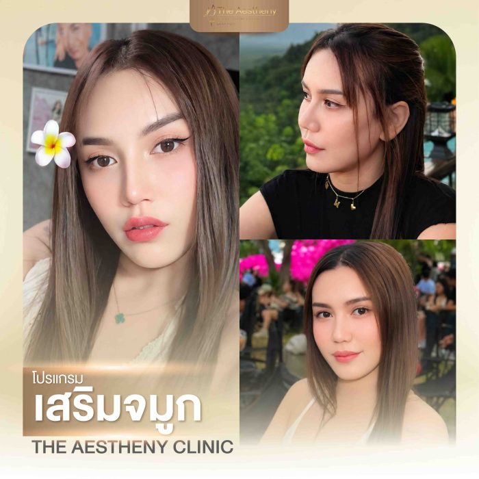 16-The Aestheny-M1-01