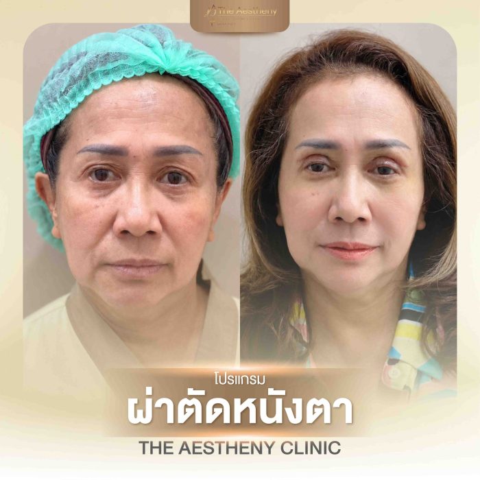 19-The Aestheny-M1-01