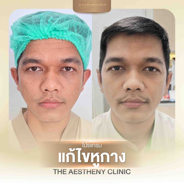 25-The Aestheny-M1-01