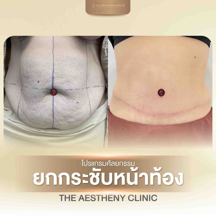 28-The Aestheny-M1-01