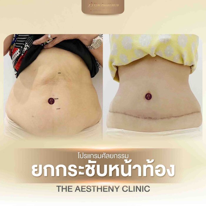 30-The Aestheny-M1-01