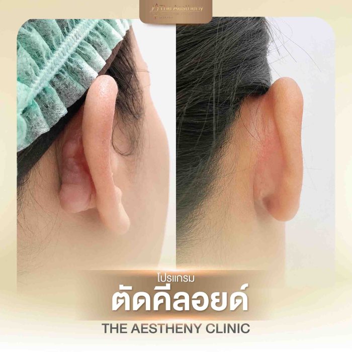 31-The Aestheny-M1-01