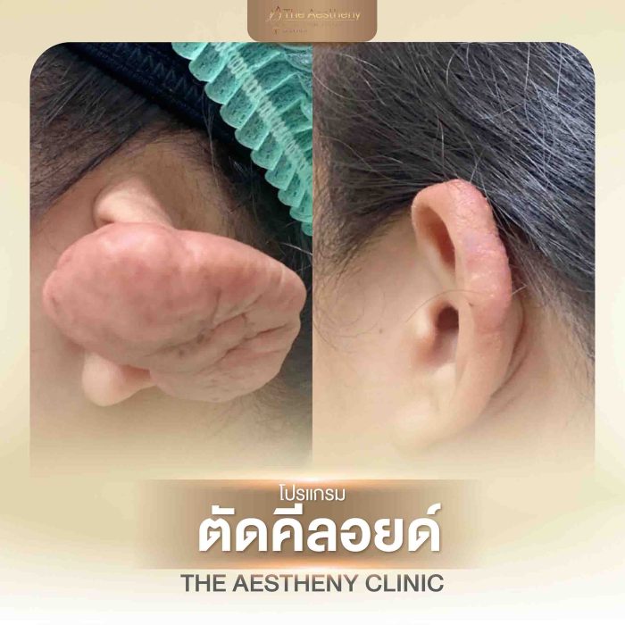 33-The Aestheny-M1-01